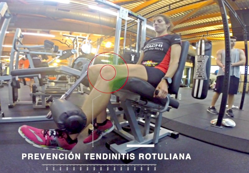 Tendinitis rotuliana: ejercicios preventivos